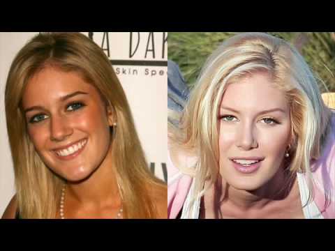 Heidi Montag: Before and After 2006-2010