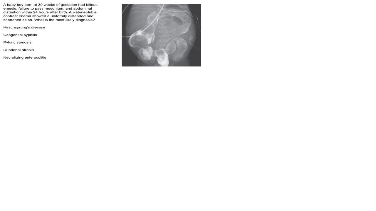 Charité Clinical Journal Club (German) by Fred Luft - 22.05.2019
