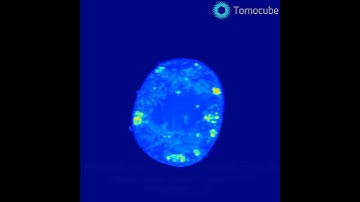 Mitosis Quantification using Holotomography