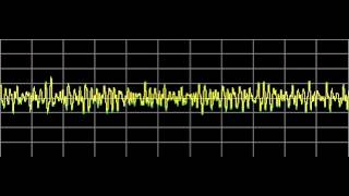 Glandular Balance - Rife Frequencies