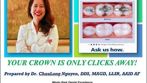 Only One-Visit CAD-CAM CEREC Porcelain Crowns