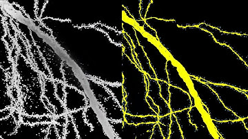 AI Tool Reveals Complete 3D Architecture of Brain Cells
