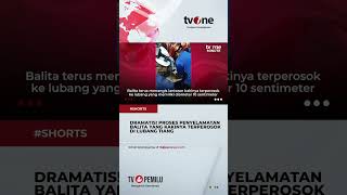 Kaki Balita Berusia Tiga Tahun Terperosok di Lubang Tiang Bulu Tangkis #shorts #tvone #news