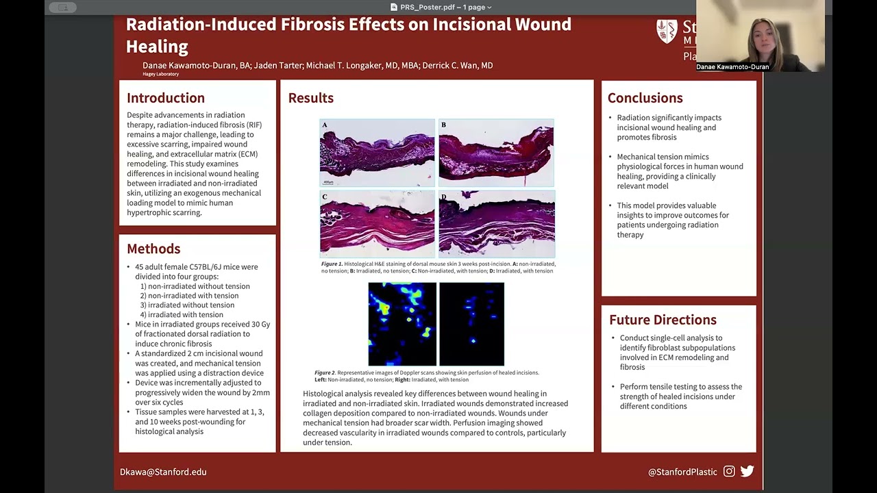 Radiation-Induced Fibrosis Effects on Incisional Wound Healing