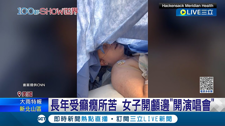 手術睡什麼 起來High! 美國女子長年受癲癇所苦 "邊開顱邊開演唱會"成功挺過手術│記者 許少榛│【國際大現場】20230719│三立新聞台