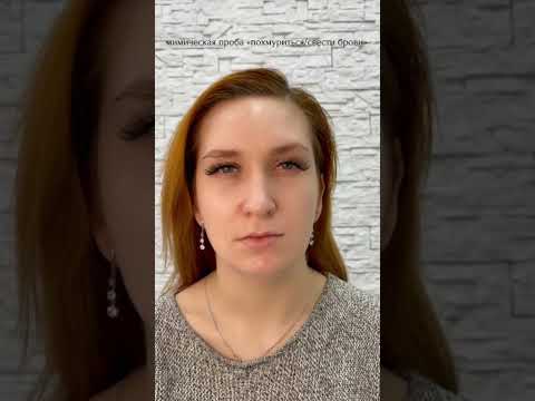 Full face:худое лицо,глабелла.Работа моей ученицы🔥 #косметологростов #худоелицо #ботоксростов
