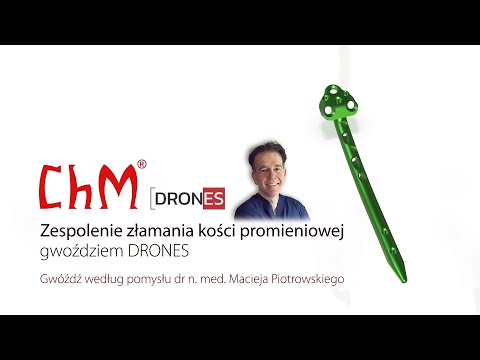 Gwóźdź promieniowy DRONES