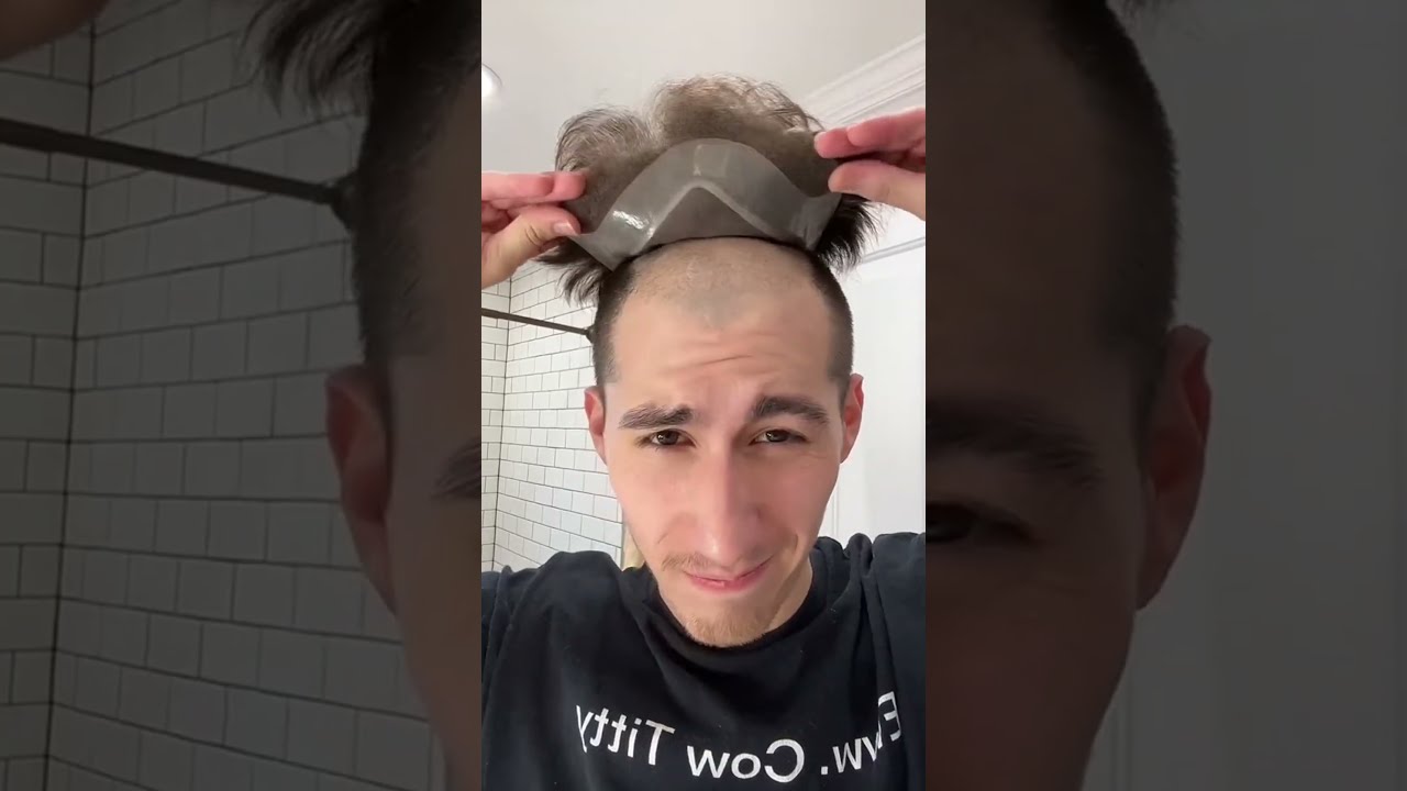 10 Seconds To Attach My Hair System Toupee Shorts