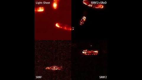 High-Speed Live-Cell 3D Ligh-Sheet Super-Resolution with SRRF and MizarTILT