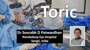 Tackling Post Toric Surprises : Dr Sourabh Patwardhan
