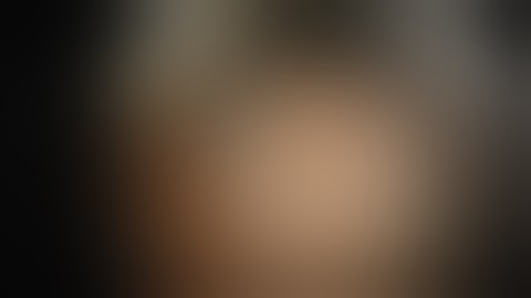 Dr. Douglas Rex: Endoscopic Mucosal Resection of the Cecum with Eleview™