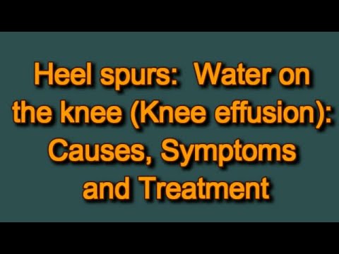 water-on-the-knee-(knee-effusion):-causes,-symptoms-and-treatment