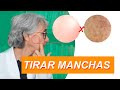 Acabe com as manchas de pele, inclusive melasma!