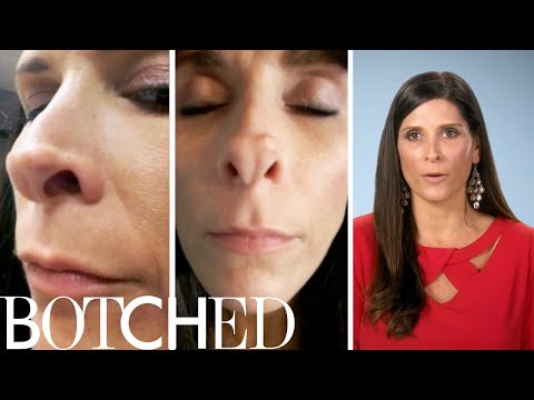 High School Athlete Wants "Hot Mess" Nose Fixed on "Botched" | E!