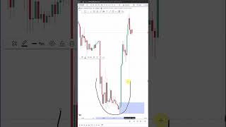 The Best Trades with Supply & Demand Zone Trading