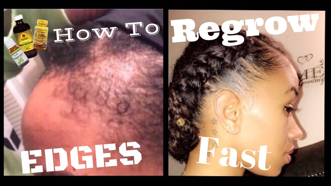 Natural Hairstyles That Don't Pull Edges