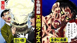 【実在】生物兵器「天然痘ウイルス」。致死率50%…全身に血膿ができる。