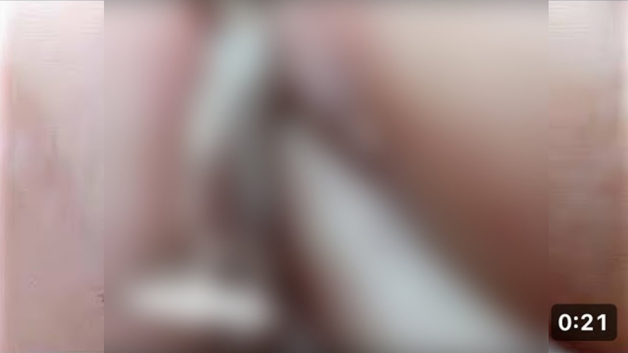 LIVE Abdominal Massage Therapy | Gas & Bloating Relief Massage Session 