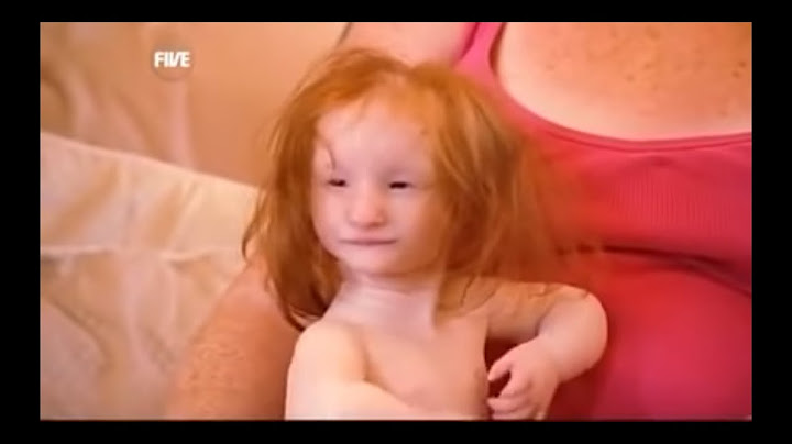 La bambina più piccola del mondo - Documentario (EN)