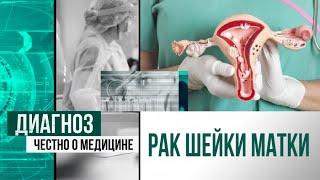 Женская онкология: как в Казахстане лечат гинекологический рак? | Диагноз