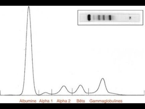 Vidéo: Augmentation de l'alpha globuline ?