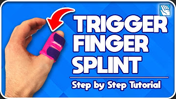 How to Make a Trigger Finger Splint - Immobilization