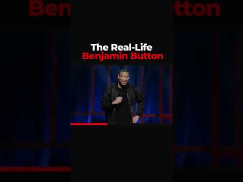 The Real-Life Benjamin Button | Michael Yo