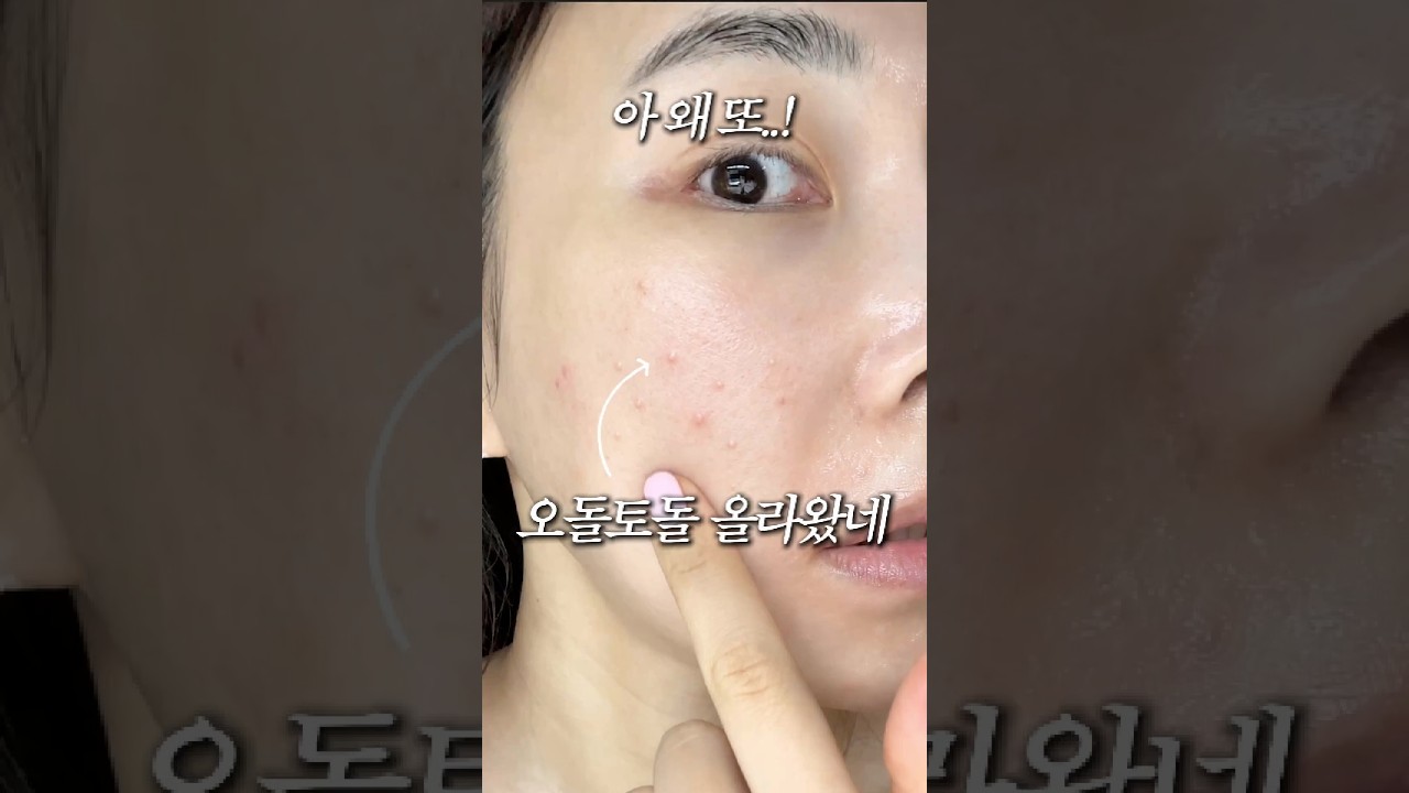 환절기만되면 오돌토돌 뒤집히는 피부, 큰돈 안들이는 관리습관 3가지