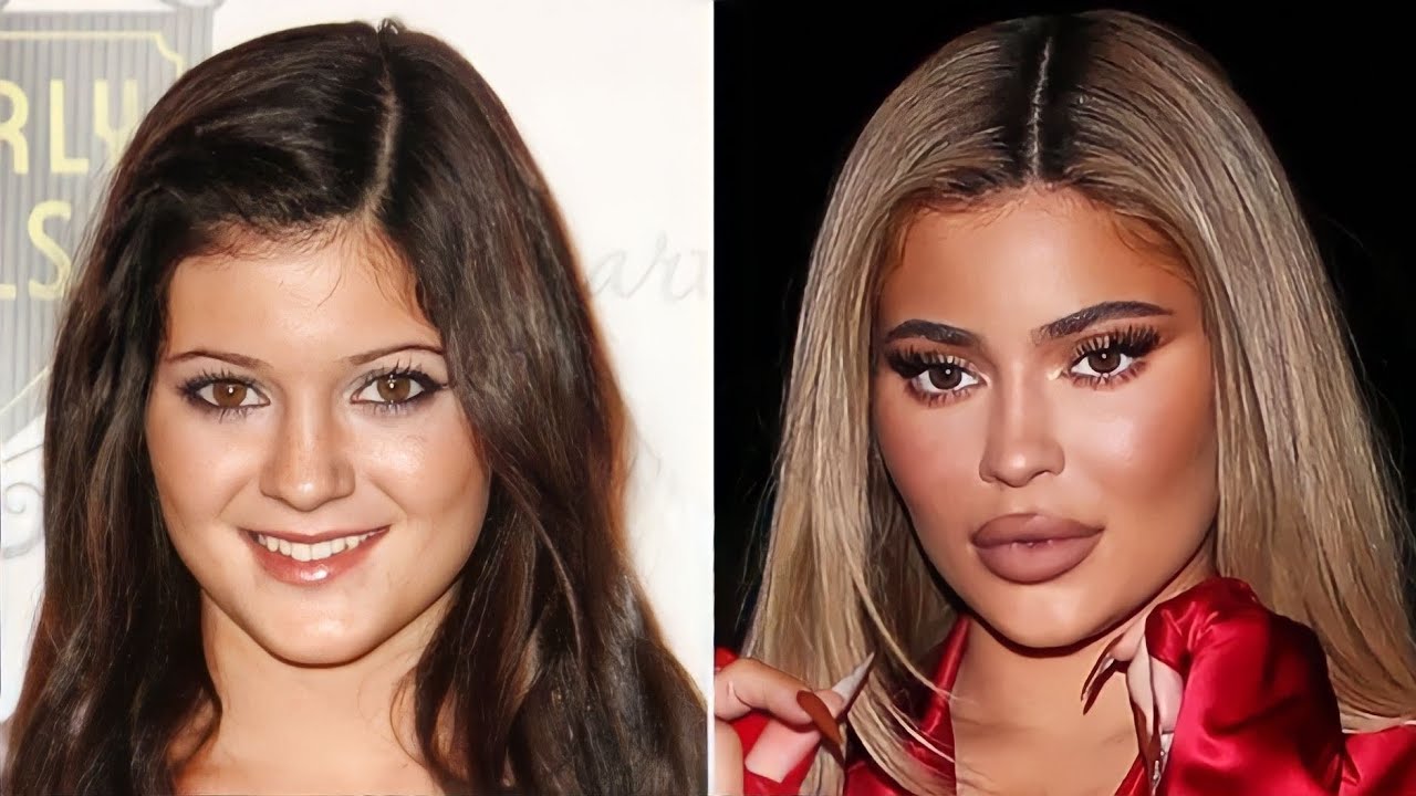 Poznati Pre i Posle Plastičnih Operacija