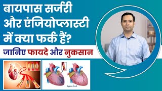 Which is Better Angioplasty or Bypass Surgery | जानिए फायदे और नुकसान | Dr.  Ashar KhanCardiologist