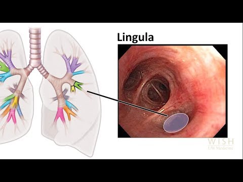 Bronchoskopie Anatomie der unteren Atemwege