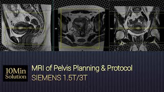 MRI Pelvis Planning Step-by-Step | Complete Tutorial for Beginners