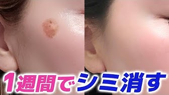 シミ取り Youtube