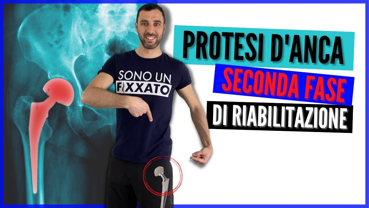 Реабилитация после замены тазобедренного сустава — упражнения и физиотерапия второго этапа