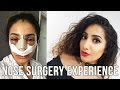 My Nose Surgery Experience VLOG