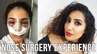 My Nose Surgery Experience VLOG