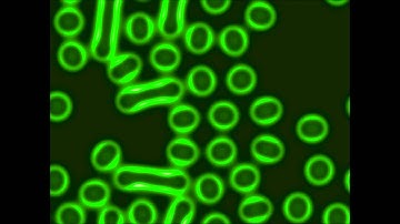 FitzHugh-Nagumo 2 Duplicating Cells.wmv