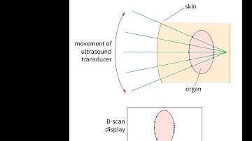 9702 A2 physics: Ultrasound