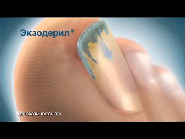 реклама Экзодерил 2013