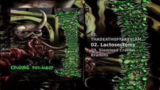 intercranialectomy — cranial remains
