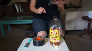 Can duct tape kill warts? Let’s look at the medical research!