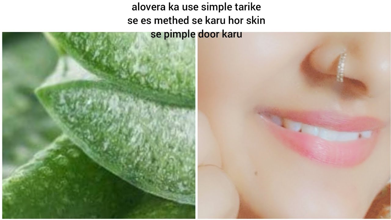 Alovera ke fayde skin ke liyeकैसे aloe vera से 3 दिन मे चहरे के दाग