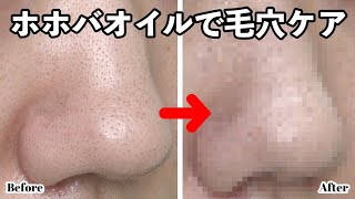 【毛穴ケア】いちご鼻撃退！？ホホバオイルで毛穴のお掃除【いちご鼻】