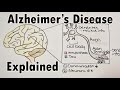 Alzheimer's disease and amyloid beta | Immune system and amyloid beta