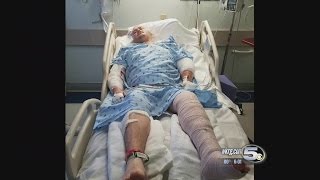 Man Recovering After Hit and Run Accident