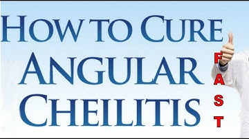 angular cheilitis healing stages - corner of mouth sore? lesions could be angular cheilitis