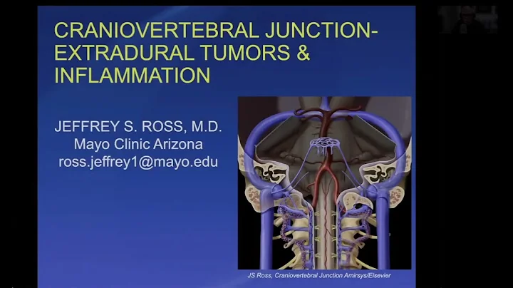 The CVJ: Degenerative, Tumor and Infection by Jeffrey S. Ross, M.D.