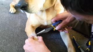 The DIY approach to surgical skin staple removal