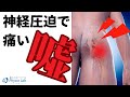 神経圧迫で痛いは、、、嘘！