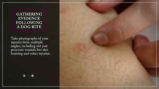 Proving Fault in Dog Bite Cases | Butler Vines and Babb